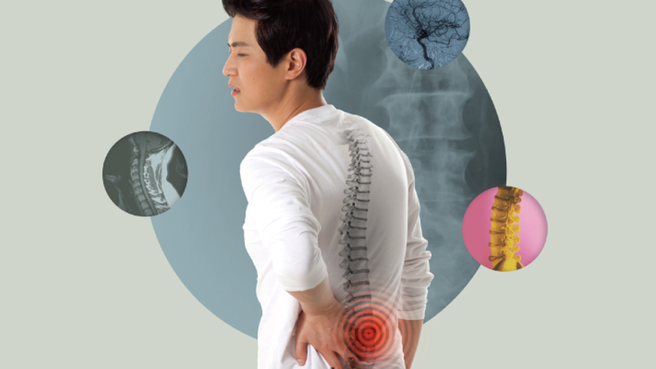 디스크(추간판 탈출증) 한약 건강보험 적용